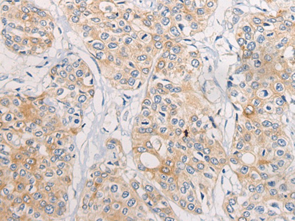 CPD Polyclonal Antibody – Figure 1 of 2
