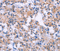 DUSP22 Polyclonal Antibody – Figure 1 of 2