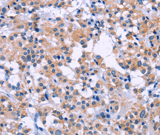 DUSP22 Polyclonal Antibody – Figure 1 of 2