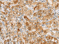 NMU Polyclonal Antibody – Figure 1 of 2