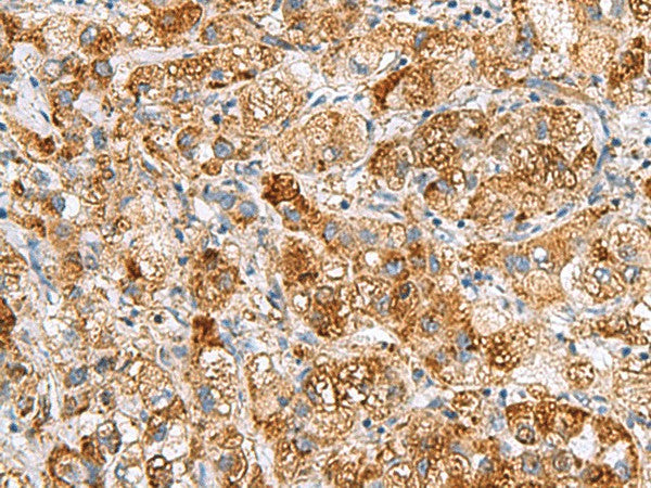 NMU Polyclonal Antibody – Figure 1 of 2