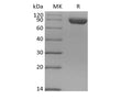 Recombinant Human Siglec-8 (C-Fc) – Figure 1 of 2