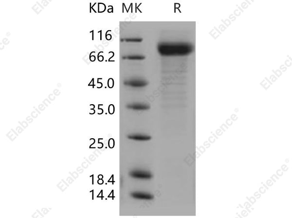 Recombinant Human IL-22BP/IL22RA2 Protein (His & Fc Tag) - Figure 1 of 2