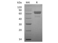 Recombinant Human CD28/TP44 Protein (Fc Tag) – Figure 1 of 2