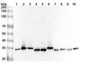 Western blot analysis was performed using anti-C1QBP polyclonal antibody at 1ug/mL on various samples.
Lane 1: Hela cell lysate
Lane 2: Jurkat cell lysate
Lane 3: K562 cell lysate
Lane 4: PC-12 cell lysate
Lane 5: C2C12 cell lysate
Lane 6: A549 cell lysate
Lane 7: Mouse spleen lysate
Lane 8: Mouse lung lysate
Lane 9: Rat spleen lysate
Lane 10: Rat lung lysate