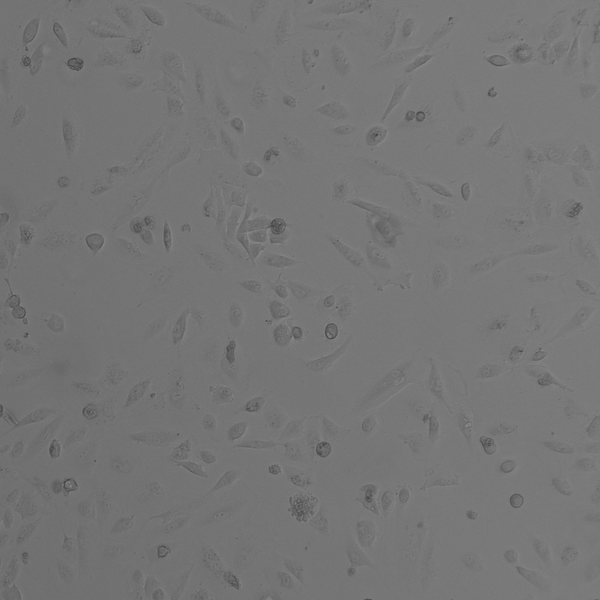 RCC-FG2 cell