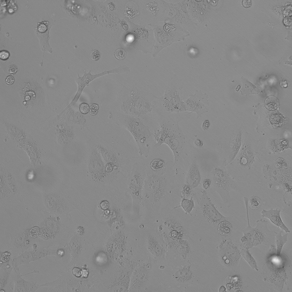 RCC-JW cell
