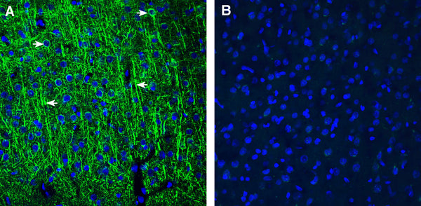Rabbit IgG Isotype Control