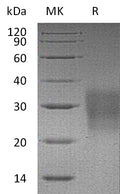 Recombinant Mouse FAS/TNFRSF6 Protein (His Tag) – Figure 1 of 2