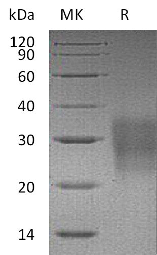 Recombinant Mouse FAS/TNFRSF6 Protein (His Tag) – Figure 1 of 2