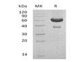 Recombinant Mouse Ephrin-A1/EFNA1 Protein (Fc & His Tag) – Figure 1 of 2
