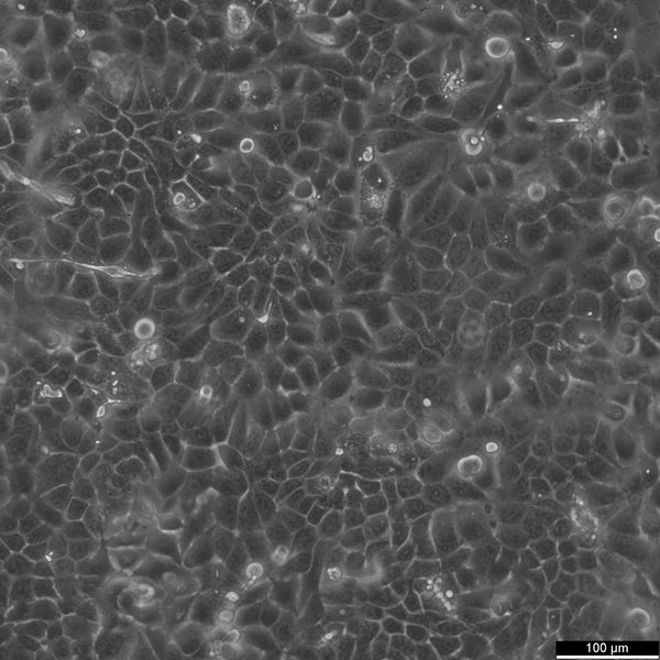 RT-112 cell