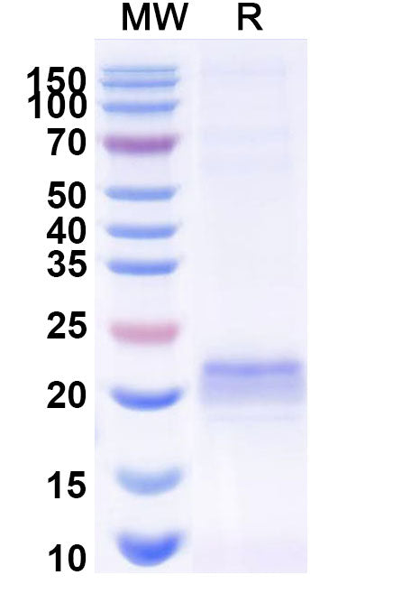SDS-PAGE for Anti-Rat ARC Nanobody (E5#)