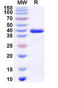 Recombinant Rat CD192/CCR2 Protein, N-GST & C-His