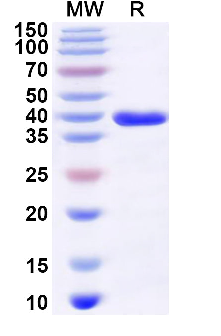 Recombinant Rat CD192/CCR2 Protein, N-GST & C-His