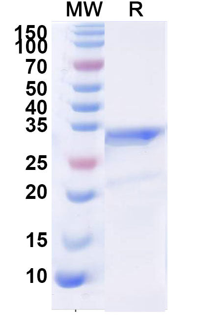 Recombinant Rat CD192/CCR2 Protein, N-GST & C-His