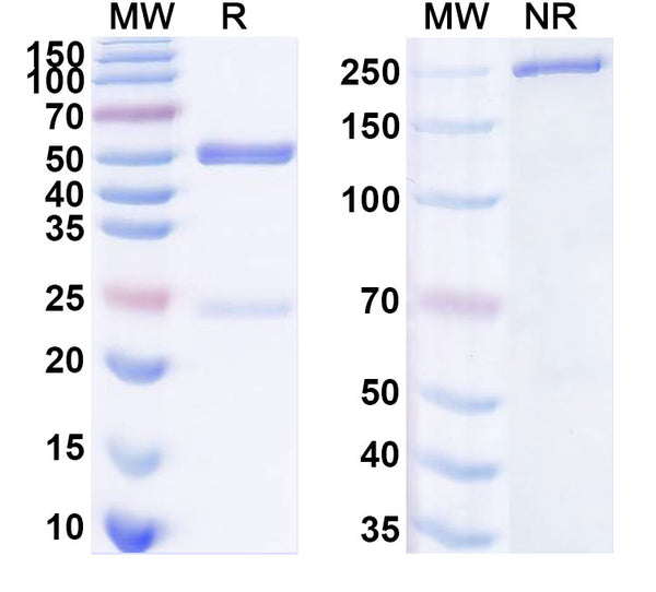 SDS-PAGE for Anti-Rat GRIA2/GluR-2 Antibody (15F1).