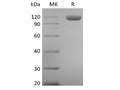 Recombinant Human Tie-2 (C-6His) – Figure 1 of 2