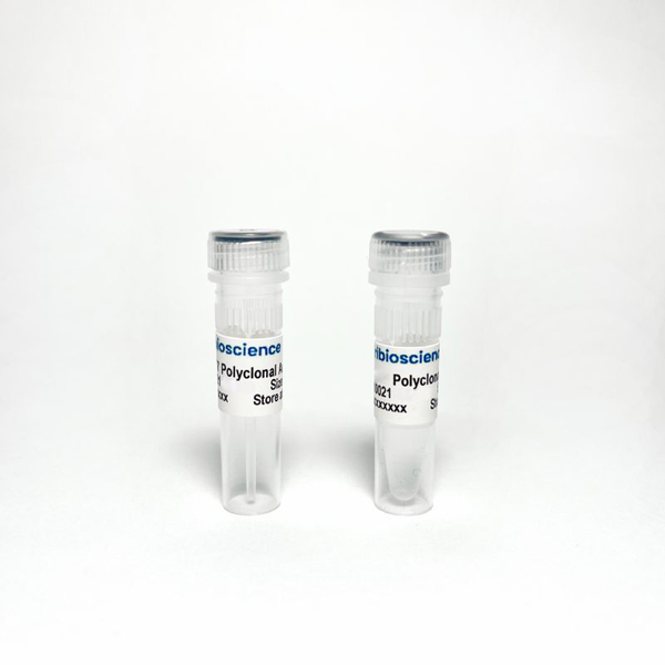 HADHA Rabbit Polyclonal Antibody – Figure 1 of 1