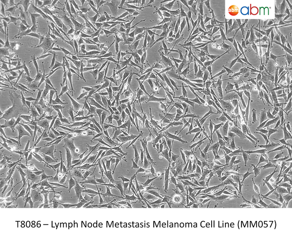 Lymph Node Metastasis Melanoma Cell Line (MM057) | Applied Biological Materials (abm)