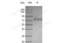 Recombinant Human SIGLEC3/CD33 Protein (Fc & His Tag) – Figure 1 of 2