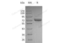 Recombinant Human Vitronectin/VTN Protein (His Tag) – Figure 1 of 3
