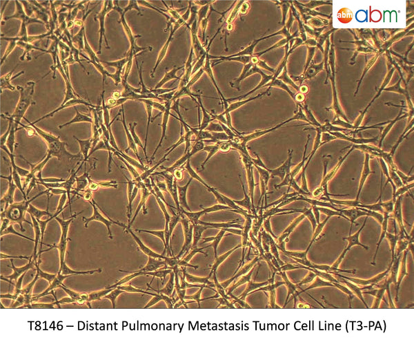 Distant Pulmonary Metastasis Tumor Cell Line (T3-PA) | Applied Biological Materials (abm)