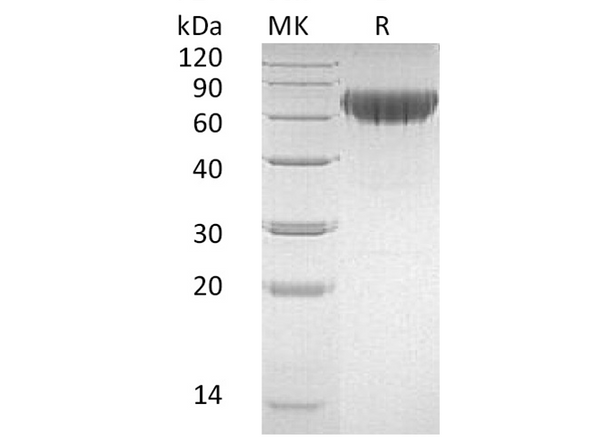Recombinant Human CD27/TNFRSF7 Protein (Fc & His Tag) – Figure 1 of 2