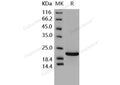 Recombinant Human TIMP2/TIMP-2 Protein – Figure 1 of 2