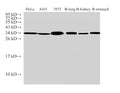 ANXA5 Polyclonal Antibody – Figure 1 of 5
