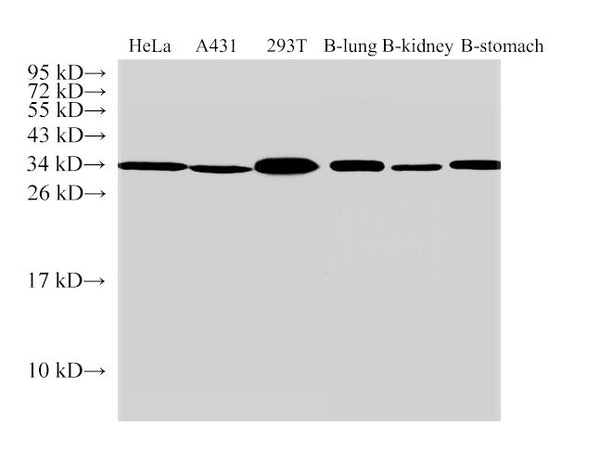 ANXA5 Polyclonal Antibody – Figure 1 of 5