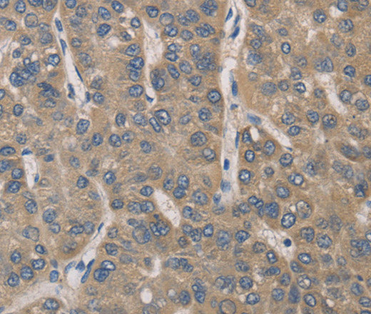 IRAK4 Polyclonal Antibody – Figure 1 of 3