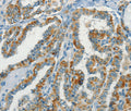 NPAP1 Polyclonal Antibody – Figure 1 of 2
