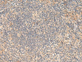 FUNDC2 Polyclonal Antibody – Figure 1 of 3