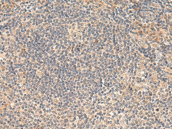 FUNDC2 Polyclonal Antibody – Figure 1 of 3