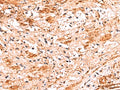 NADK Polyclonal Antibody – Figure 1 of 2