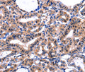 FBN1 Polyclonal Antibody – Figure 1 of 2
