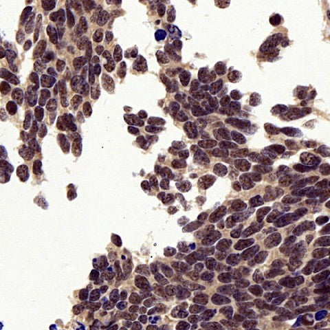 P38 Polyclonal Antibody – Figure 1 of 4