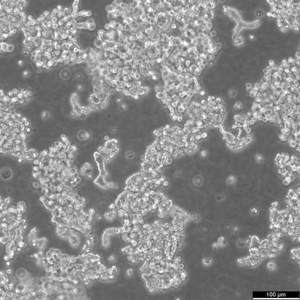 SCLC-21H cell