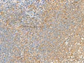 GRIK2 Polyclonal Antibody – Figure 1 of 2