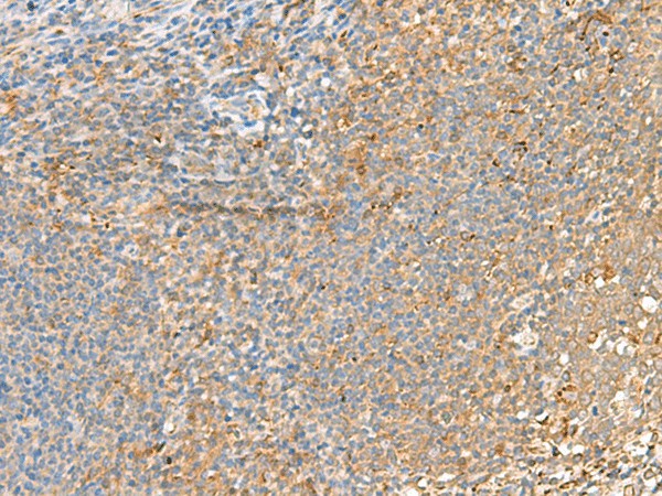 GRIK2 Polyclonal Antibody – Figure 1 of 2