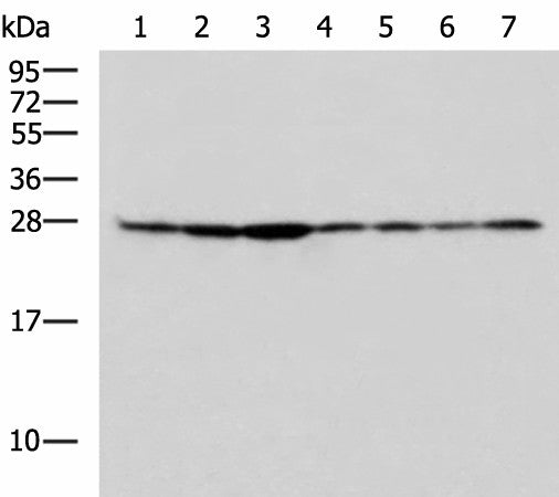 RPL10A Polyclonal Antibody – Figure 1 of 4