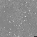 SCaBER cell