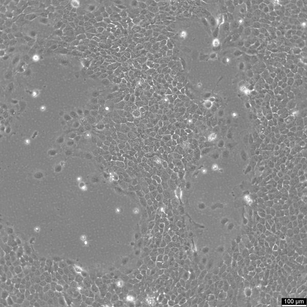 SCaBER cell
