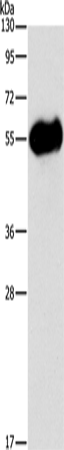 AMY2A Polyclonal Antibody – Figure 1 of 4