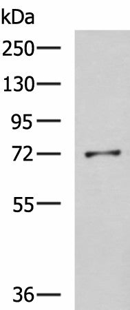 GSTCD Polyclonal Antibody – Figure 1 of 3