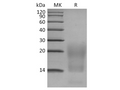 Recombinant Human BCMA/TNFRSF17 Protein (His Tag) - Figure 1 of 3