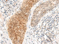 GHDC Polyclonal Antibody – Figure 1 of 3