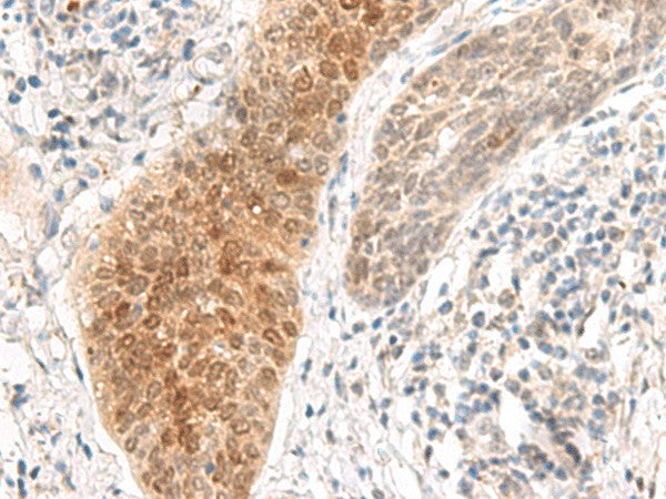 GHDC Polyclonal Antibody – Figure 1 of 3