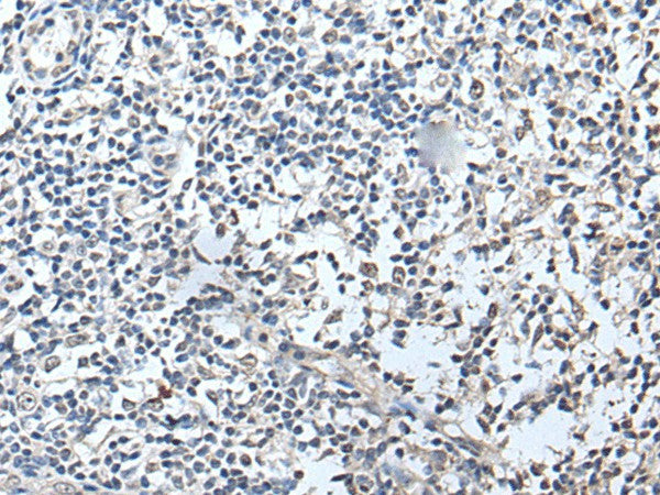 RERG Polyclonal Antibody – Figure 1 of 2